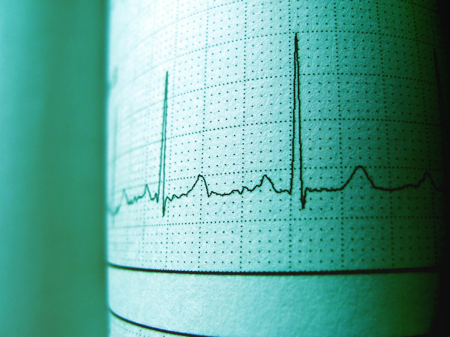 Top Private Equity Cardiology firms in 2026